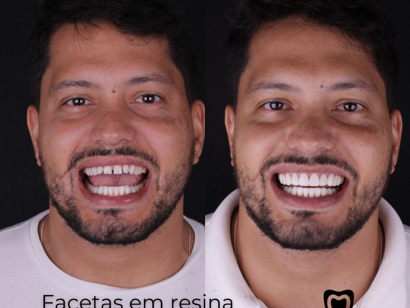 Foto 11 de Maurício Morato Odontologia Integrada