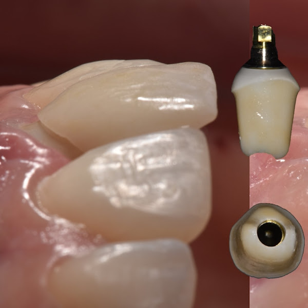 Foto 2 de Maurício Tomazoni - Prótese & Estética Dentária - Zona Sul