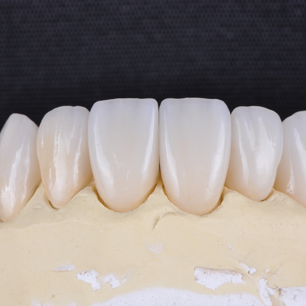 Foto 3 de Mauro Lefrançois Odontologia | Dentista em Niterói | Restauração em Resina | Implante Dentário | Restauração de porcelana