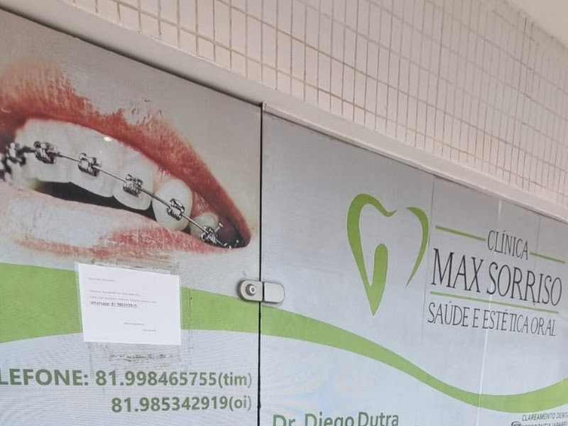 Foto de MAX SORRISO | Saúde e Estética Oral Clínica Odontológica no Janga em Paulista PE