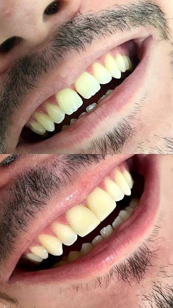 Foto 3 de Maxiclin ODONTOLOGIA I Implantes | Ortodontia | DTM | Facetas | Odontopediatria | Invisalign | Clínica Geral | Clareamento