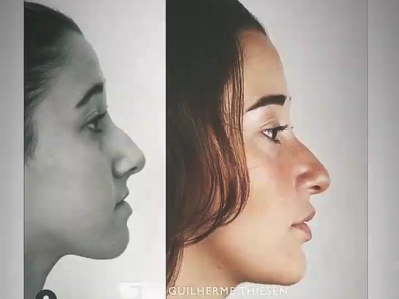 Foto 10 de Maxillofacial Odontologia Especializada Ltda