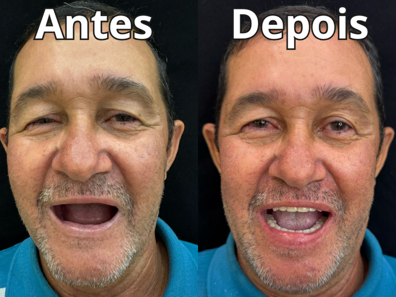 Foto 2 de Maxilo facial tips