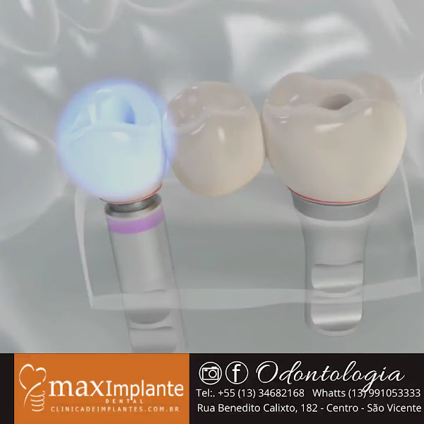 Foto 3 de Maximplante Clínica Odontológica - Implante dentario, Ortodontia, Odontologia Digital