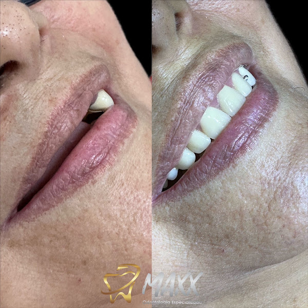 Foto 3 de Maxx Odontologia | Implante Dentário | Dentistas