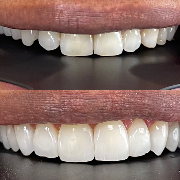 Foto 2 de MAYRINK ODONTOLOGIA