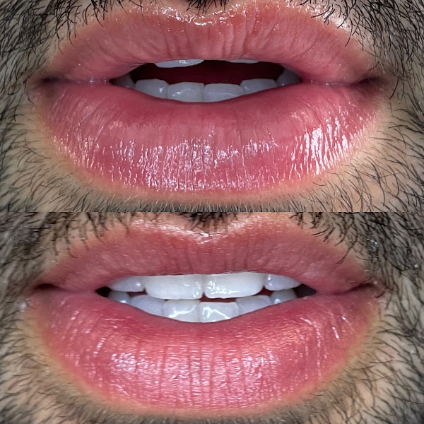 Foto 3 de MAYRINK ODONTOLOGIA