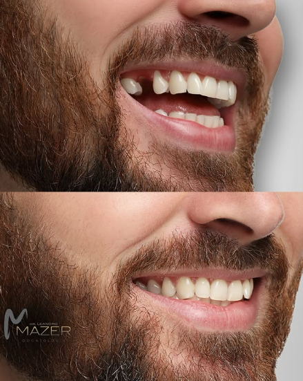 Foto 3 de Mazer Odontologia | Implantes e Prótese Dentária | Dentista Rio Preto
