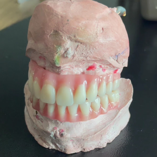 Foto 4 de MB Odontologia - Dr Márcio Bezerra - Implante Dentário em Belém