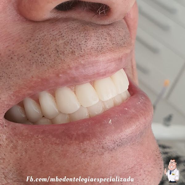 Foto 2 de MB Odontologia Especializada