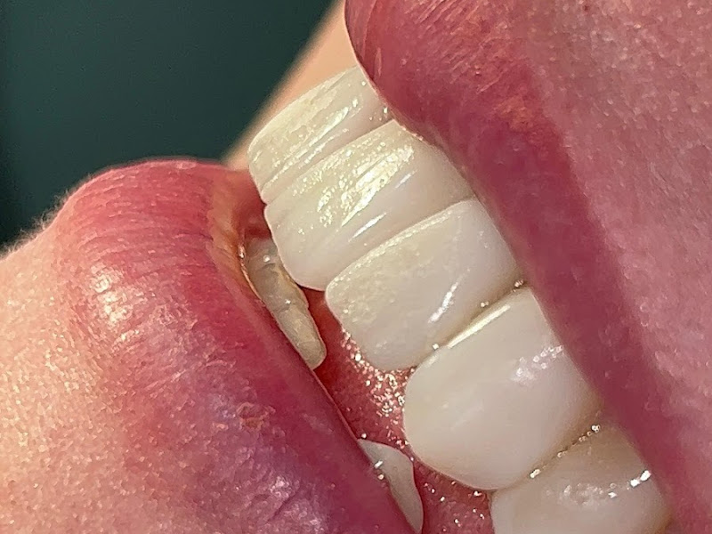 Foto 3 de MC - Implantes, Siso e Odontologia Estética