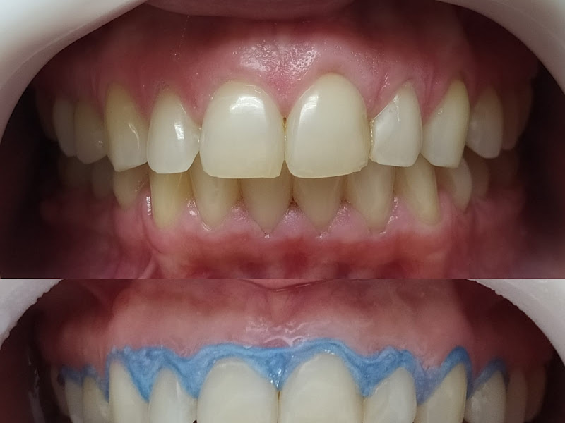 Foto 7 de MCR Odontologia - Unidade Santana