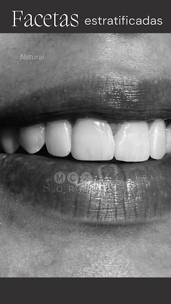 Foto 3 de MCZ Sorrisos (Cidade Universitária)