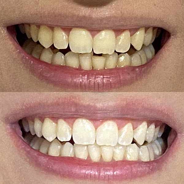 Foto 3 de ME Odontologia - Dra Eliza Jorge