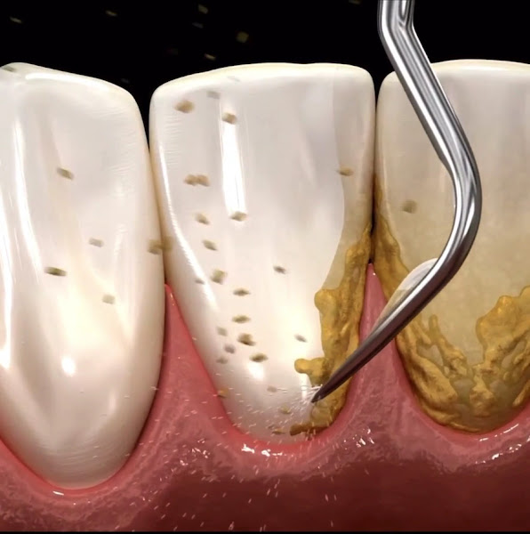 Foto 3 de Meddent Nova Iguaçu