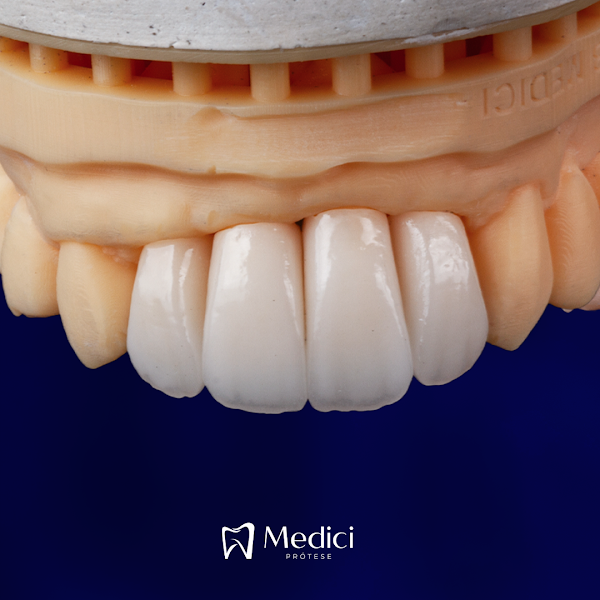 Foto 2 de Medici Prótese Dentária