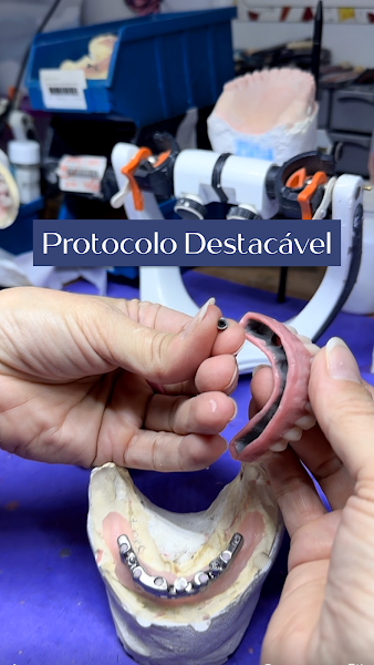 Foto 3 de Medici Prótese Dentária