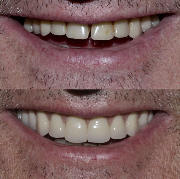 Foto 2 de Meirihellen Cinelli Odontologia Estética