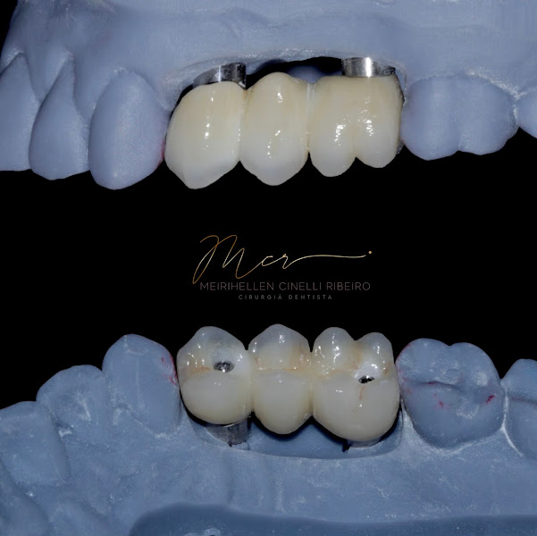 Foto 3 de Meirihellen Cinelli Odontologia Estética