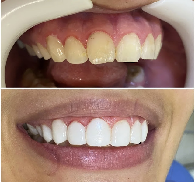 Foto 2 de Melhor Clínica Odontológica em São Mateus Sorria de novo