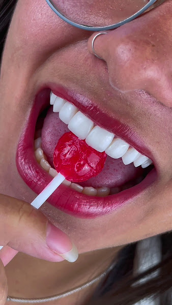 Foto 3 de Melhor Sorriso Jequié – Implantes e Lentes Dentárias