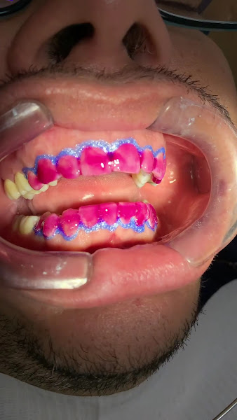 Foto 3 de Mencer Odontologia