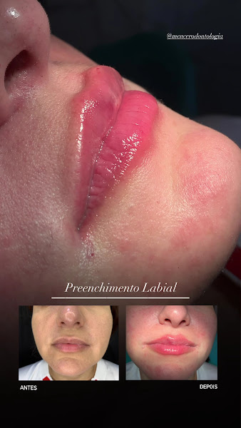 Foto 4 de Mencer Odontologia