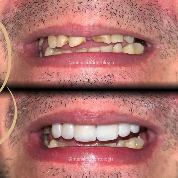 Foto 5 de Mencer Odontologia