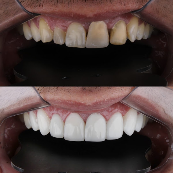 Foto 3 de Menezes Odontologia