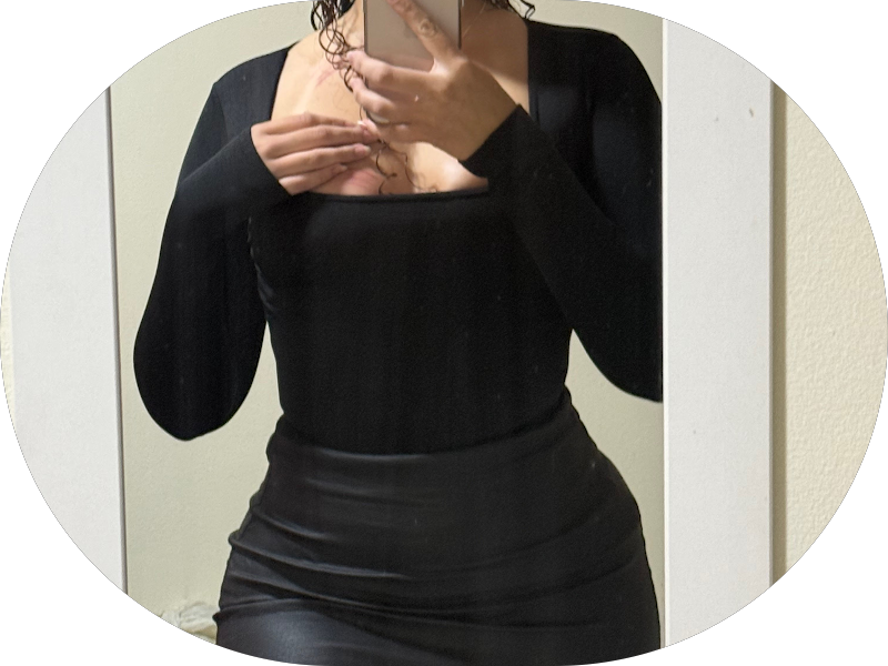 Foto 5 de Merino Odontologia | Dra. Carolina Merino | Dentista Guarulhos | Invisalign | SouSmile.