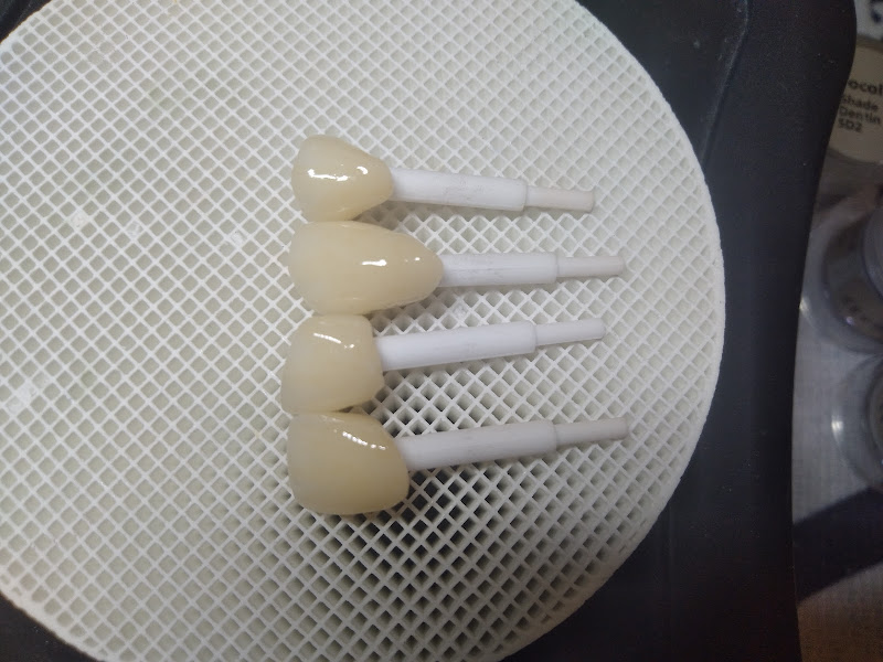 Foto 2 de Mesiolab Soluções Protéticas