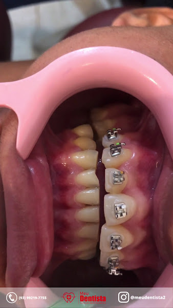 Foto 4 de Meu Dentista Clínicas Odontológicas