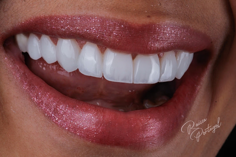 Foto 2 de Meu Sorriso