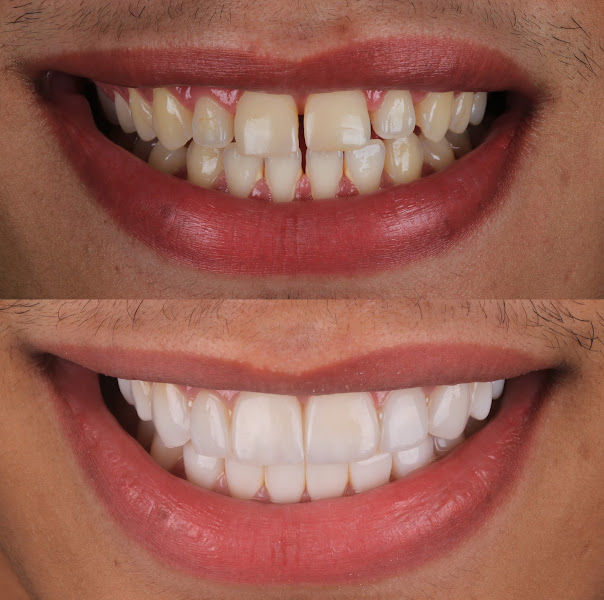 Foto 2 de MF Odontologia