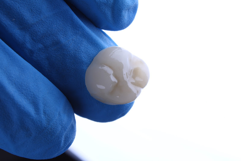 Foto 2 de MF Odontologia Estética | Implantes e Lentes em Porcelana e Resina Uberaba