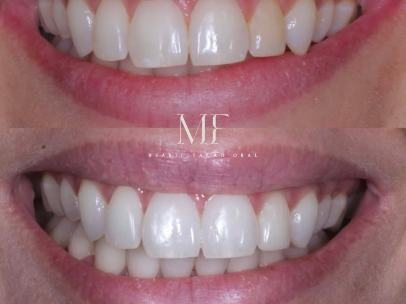 Foto de MF Reabilitação Oral