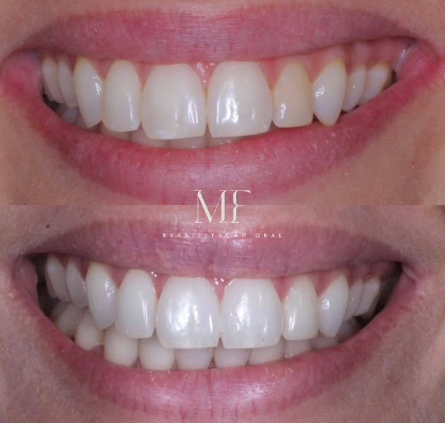 Foto 2 de MF Reabilitação Oral
