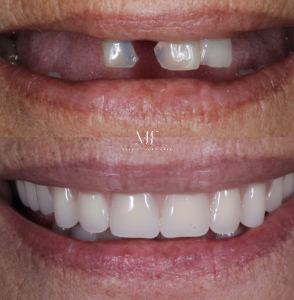 Foto 3 de MF Reabilitação Oral
