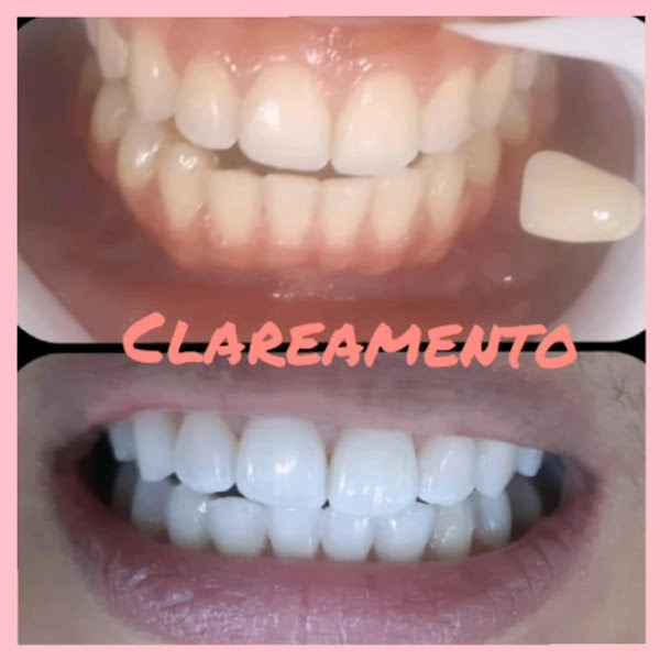 Foto 3 de MG Odontologia clinica e Estética - dentista Manaus