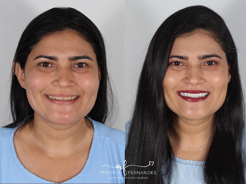 Foto 3 de Michele Fernandes - Odontologia e Saúde