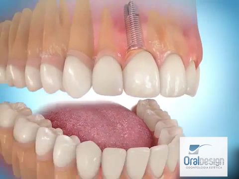 Foto 3 de Mil Sorrisos Odontologia Especializada - Balneário Meia Ponte