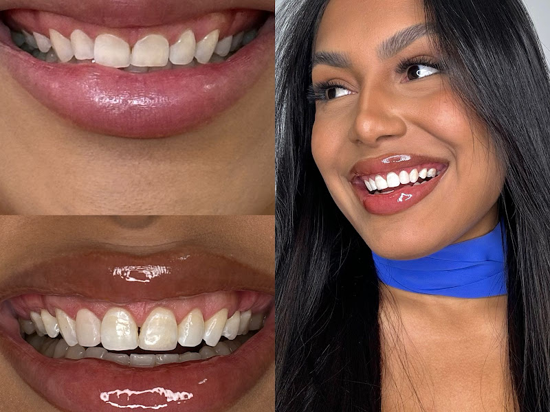 Foto 7 de Milena Oliveira | Dentista em Americana