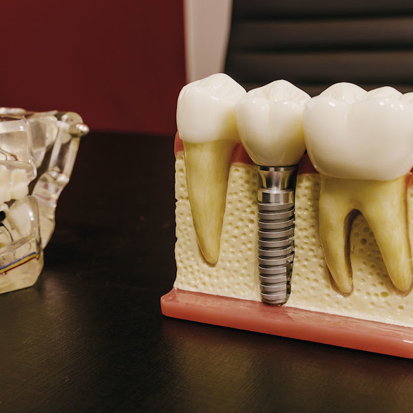 Foto 3 de Miracle Smile Odontologia- Dra. Cristiane Rodrigues Rosa