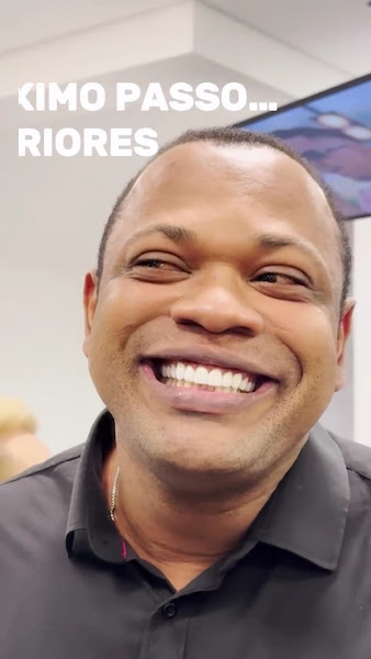 Foto 3 de Miranda Coutinho | Lentes de Contato Dental | Implante Dentário em Joinville