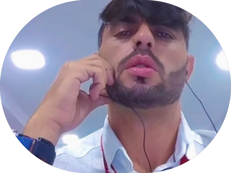 Foto 5 de Miranda Coutinho | Lentes de Contato Dental | Implante Dentário em Joinville