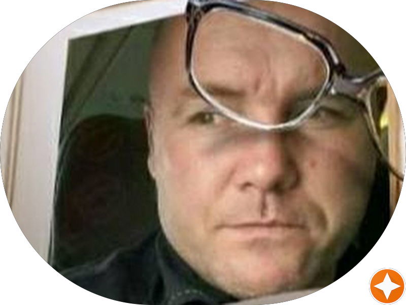 Foto 6 de Miranda Coutinho | Lentes de Contato Dental | Implante Dentário em Joinville