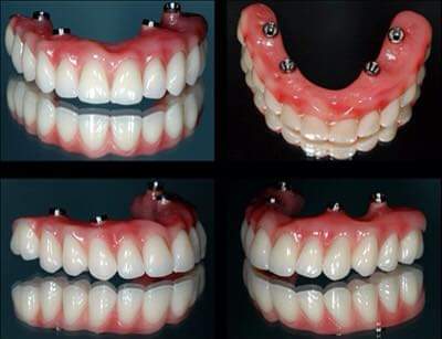 Foto 2 de MLCardoso Odontologia (Dr.Marcos Luiz Cardoso)
