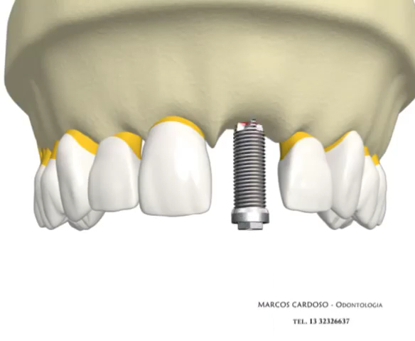 Foto 3 de MLCardoso Odontologia (Dr.Marcos Luiz Cardoso)