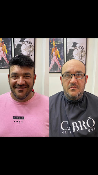 Foto 3 de MM Estética Capilar - PRÓTESE CAPILAR