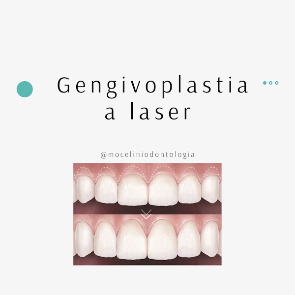 Foto 3 de Mocelini Odontologia / Invisalign em Sinop MT